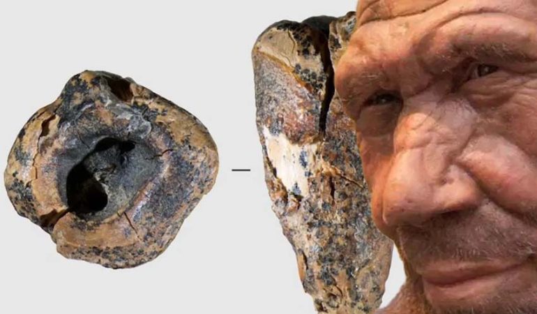 Neandertaller 60 bin yıl önce taş matkapla diş tedavisi yapmış olabilir